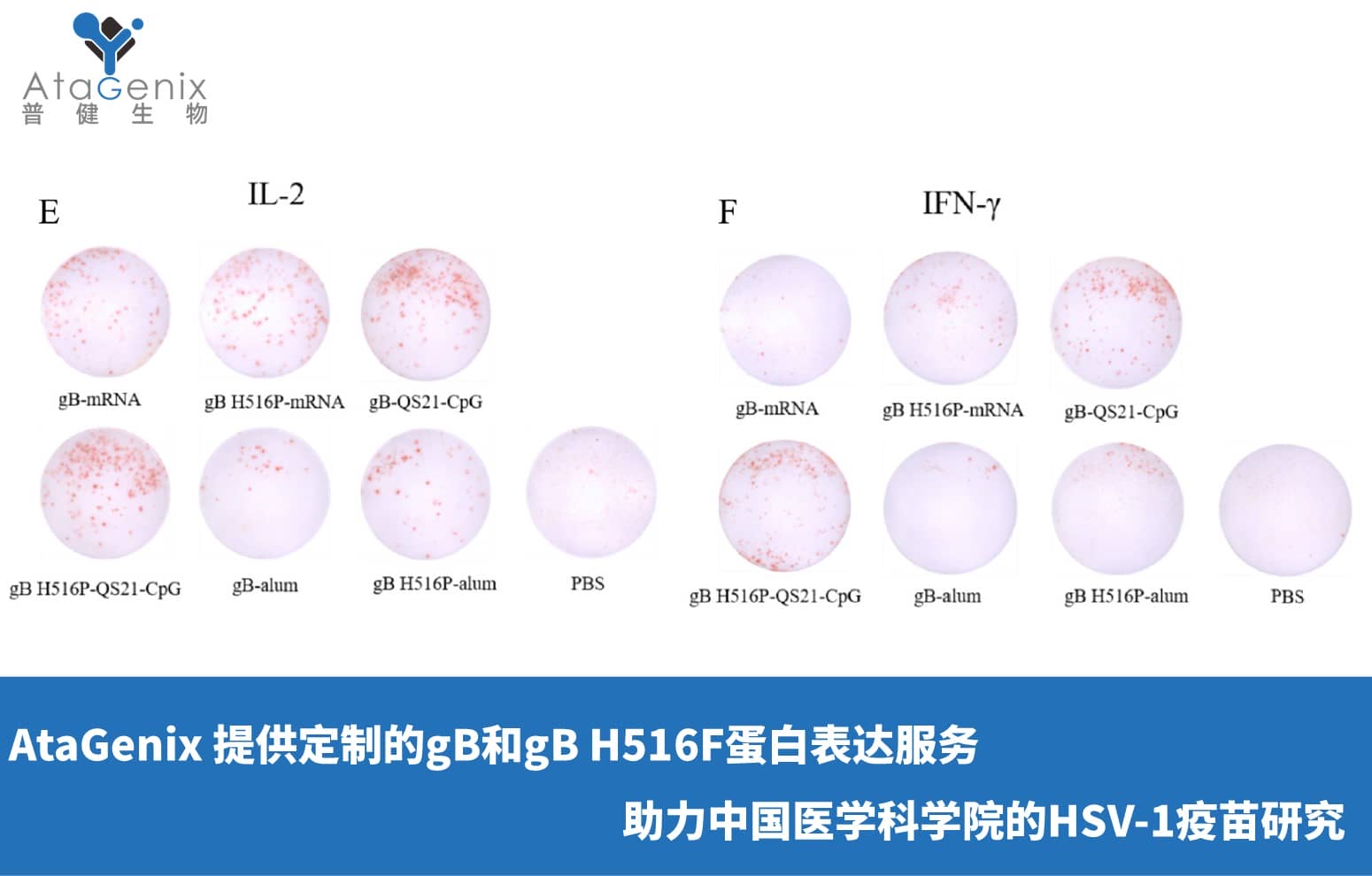 AtaGenix 提供定制gB和gB H516F蛋白表達服務，助力中國醫(yī)學科學院HSV-1疫苗研究