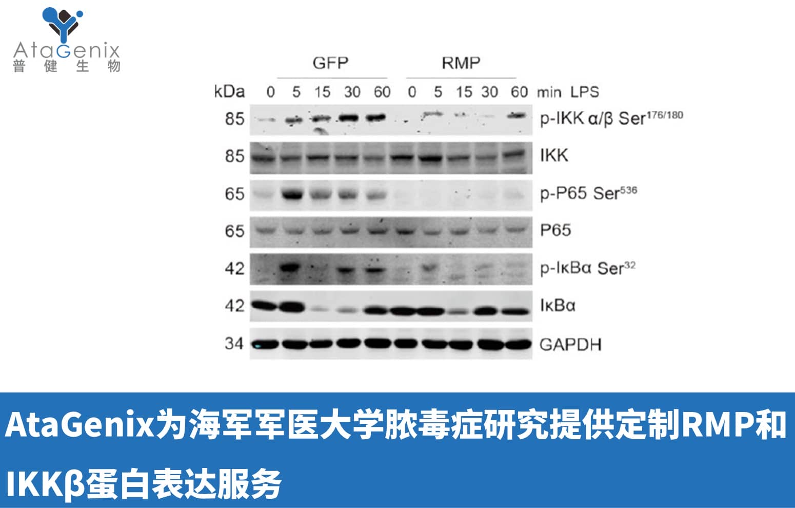 AtaGenix為海軍軍醫(yī)大學膿毒癥研究提供定制RMP和IKKβ蛋白表達服務